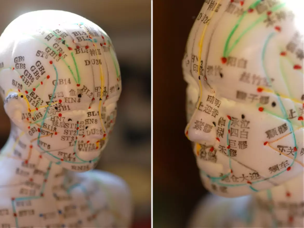 Trajets des méridiens  et des points d'acupuncture de la tête